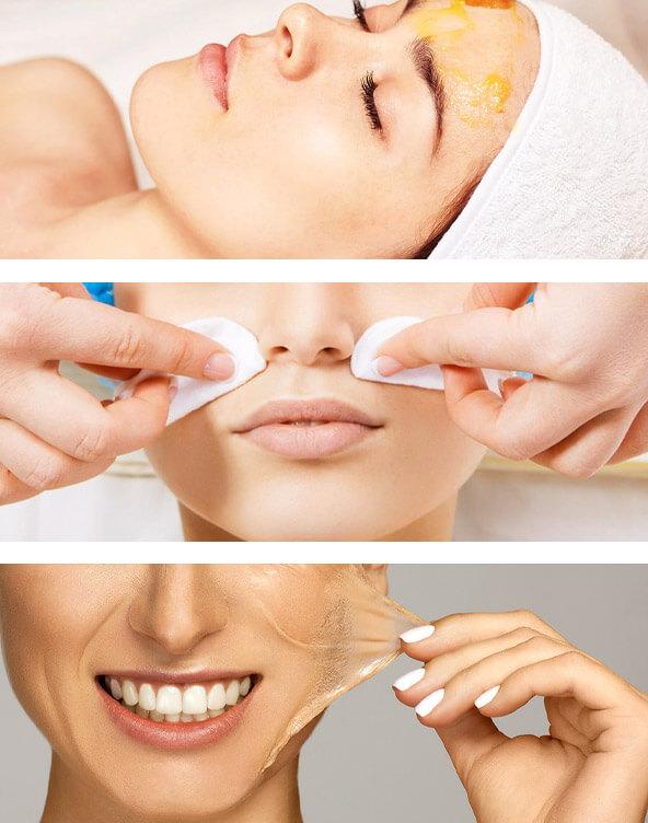 Muse Troy, MI - Medical Spa Chemical Peels Blemishes