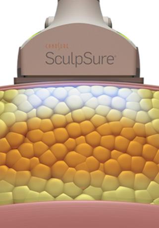 services_sculpsure_02-2