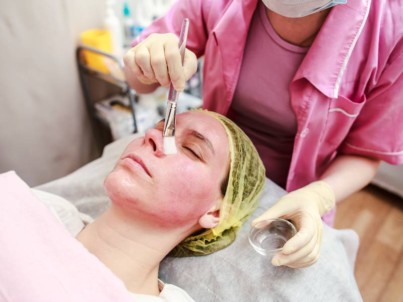 Are Chemical Peels Worth it?