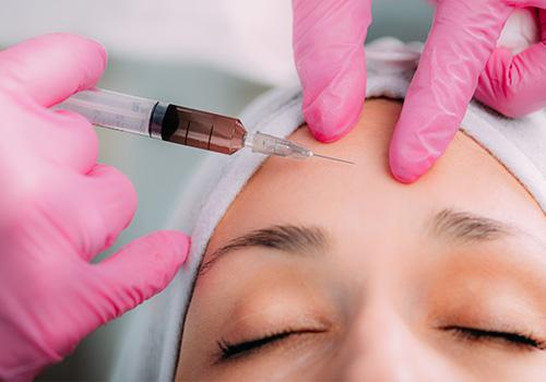 PRP for Cosmetic Facial Procedures