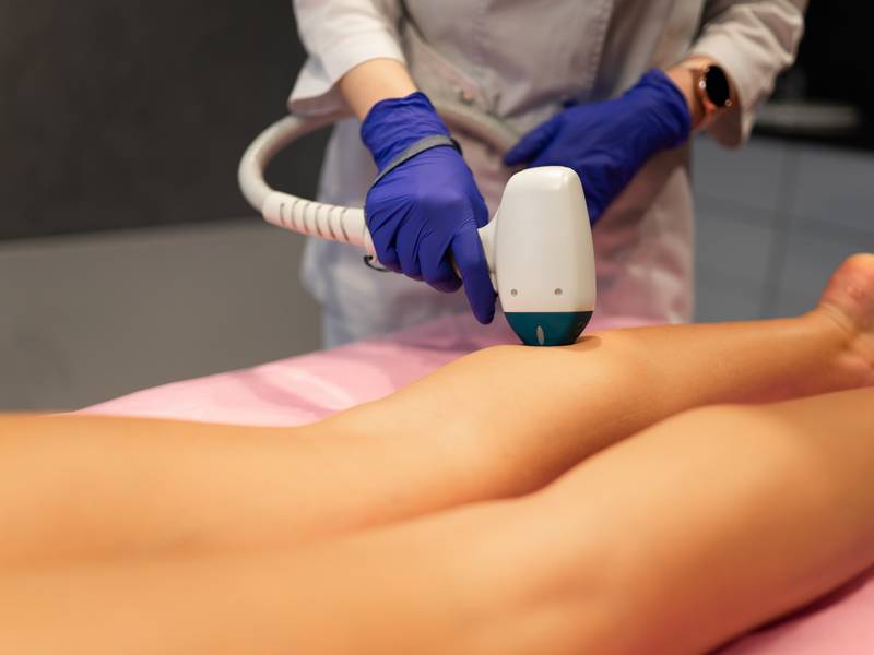 How Does Laser Hair Removal Work?