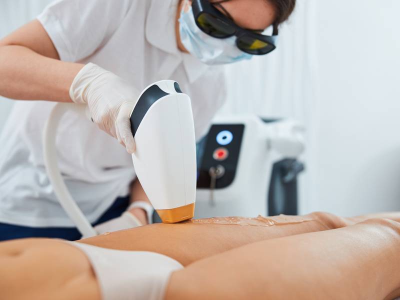 Why is Laser Hair Removal So Popular?