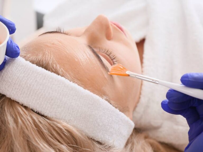 What Are Chemical Peels?