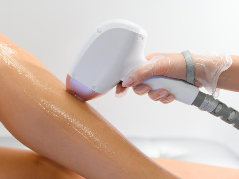Laser Hair Removal Gives You One Less Thing to Think About