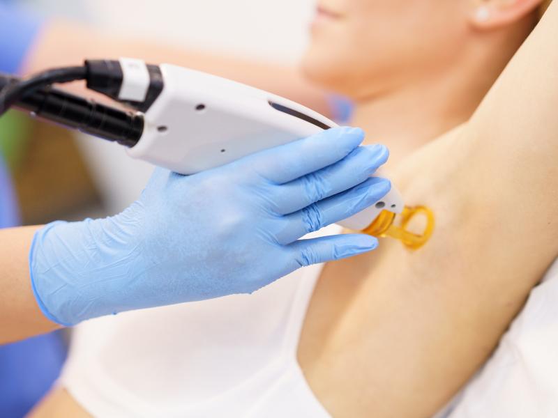 Laser Hair Removal in Troy, MI Means Less Time Shaving and More Looking Great